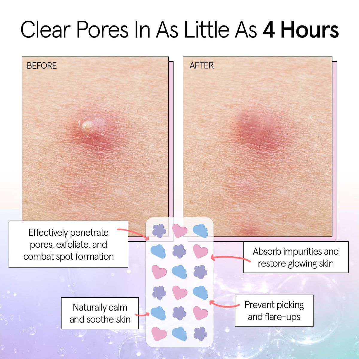 grace & stella patch applied to cheek demonstrating discreet coverage
