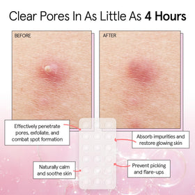 grace & stella patch applied on facial spot showing discreet protection