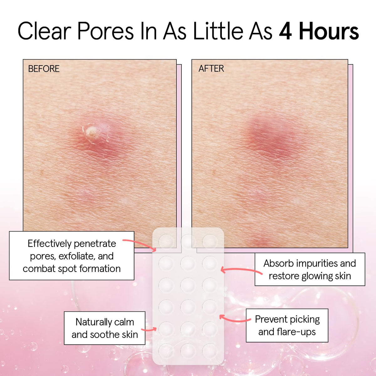 grace & stella patch applied to cheek demonstrating protective seal