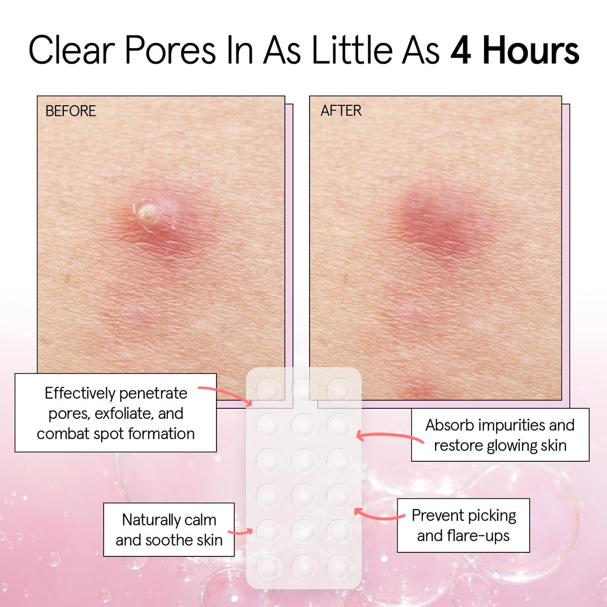 grace & stella clear patch on face during daytime offering invisible coverage and confidence