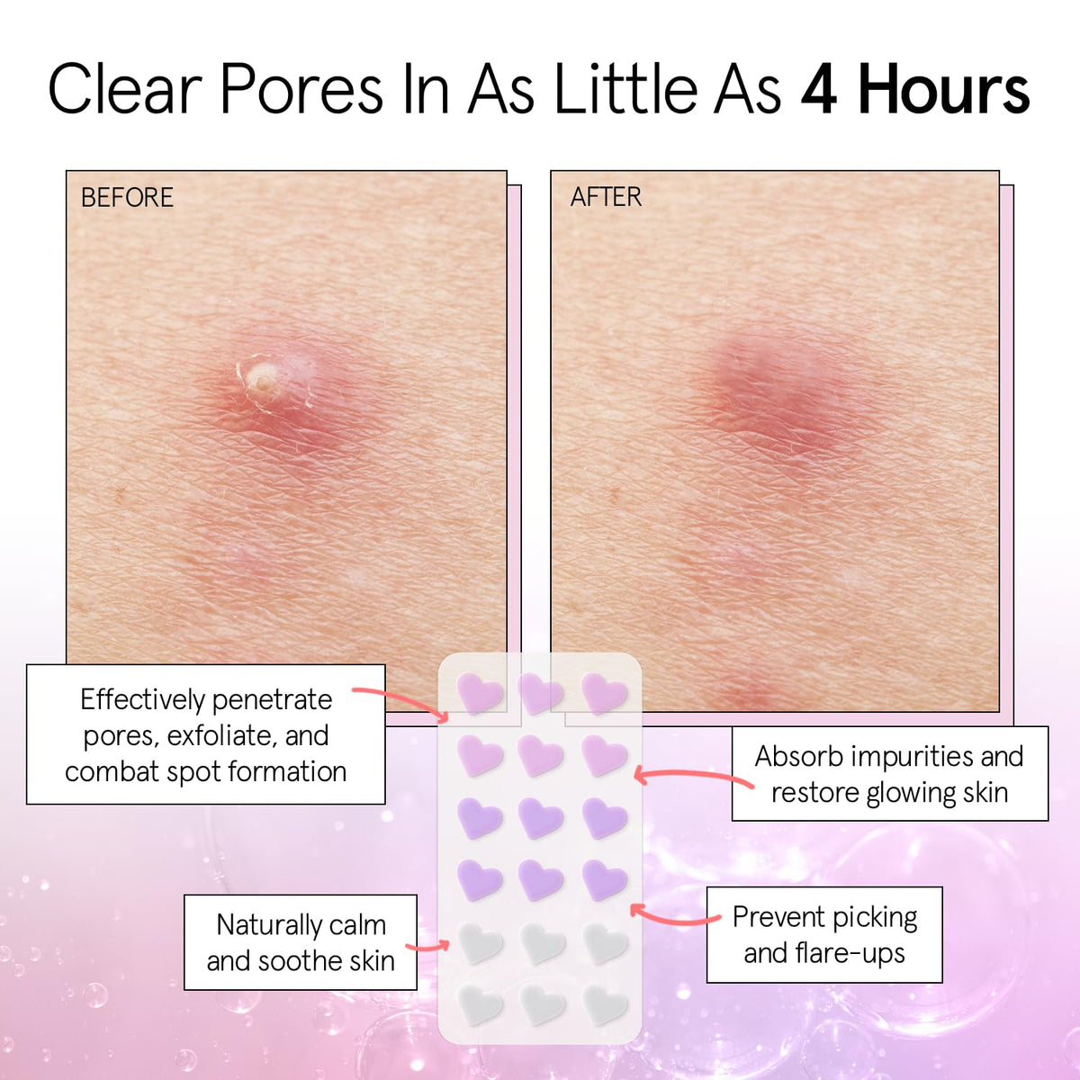 grace & stella heart patch applied to skin, discreet concealment and protection