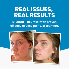 Grahams Natural used on face demonstrating gentle care for sensitive areas