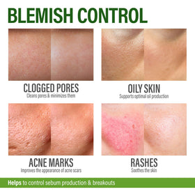 GRAMRIGHT cream on fingertip demonstrating easy spot application benefit