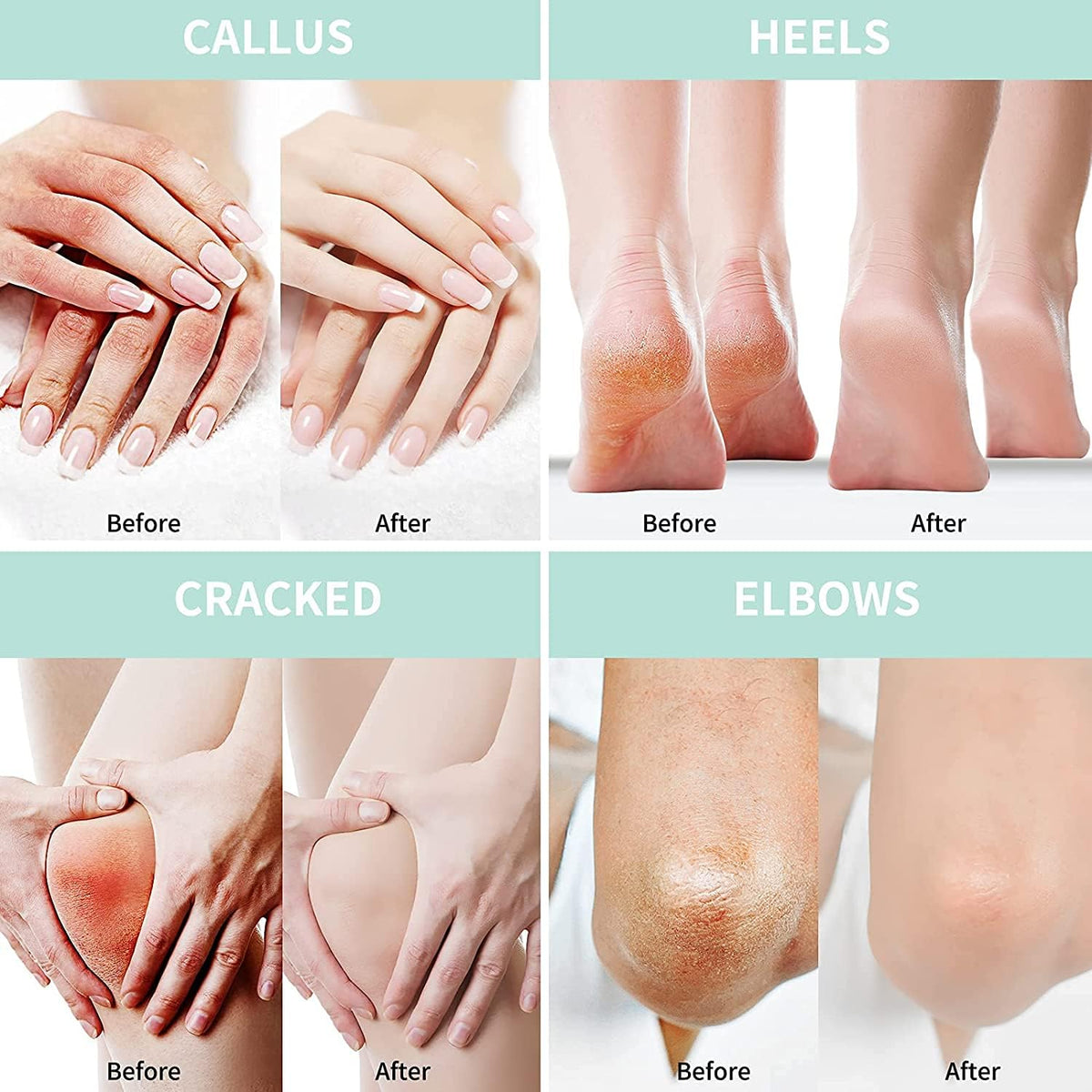 Grocerism application on heel demonstrating targeted use to soften calluses effectively