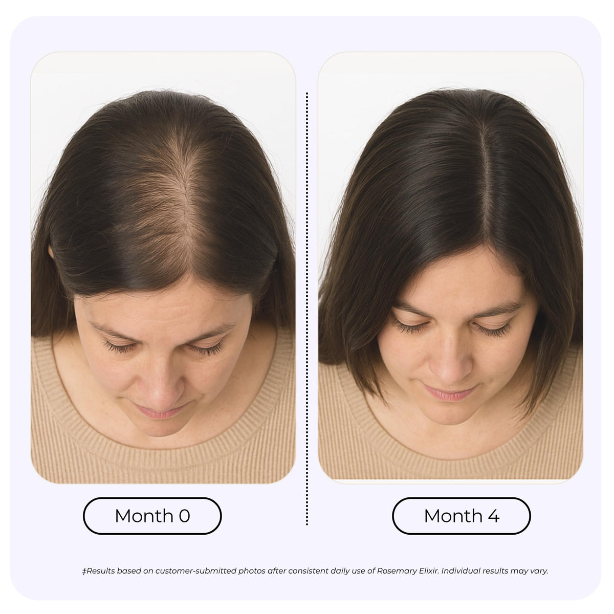 GROWPLEX applying oil to scalp demonstrating gentle massage and comfort benefit