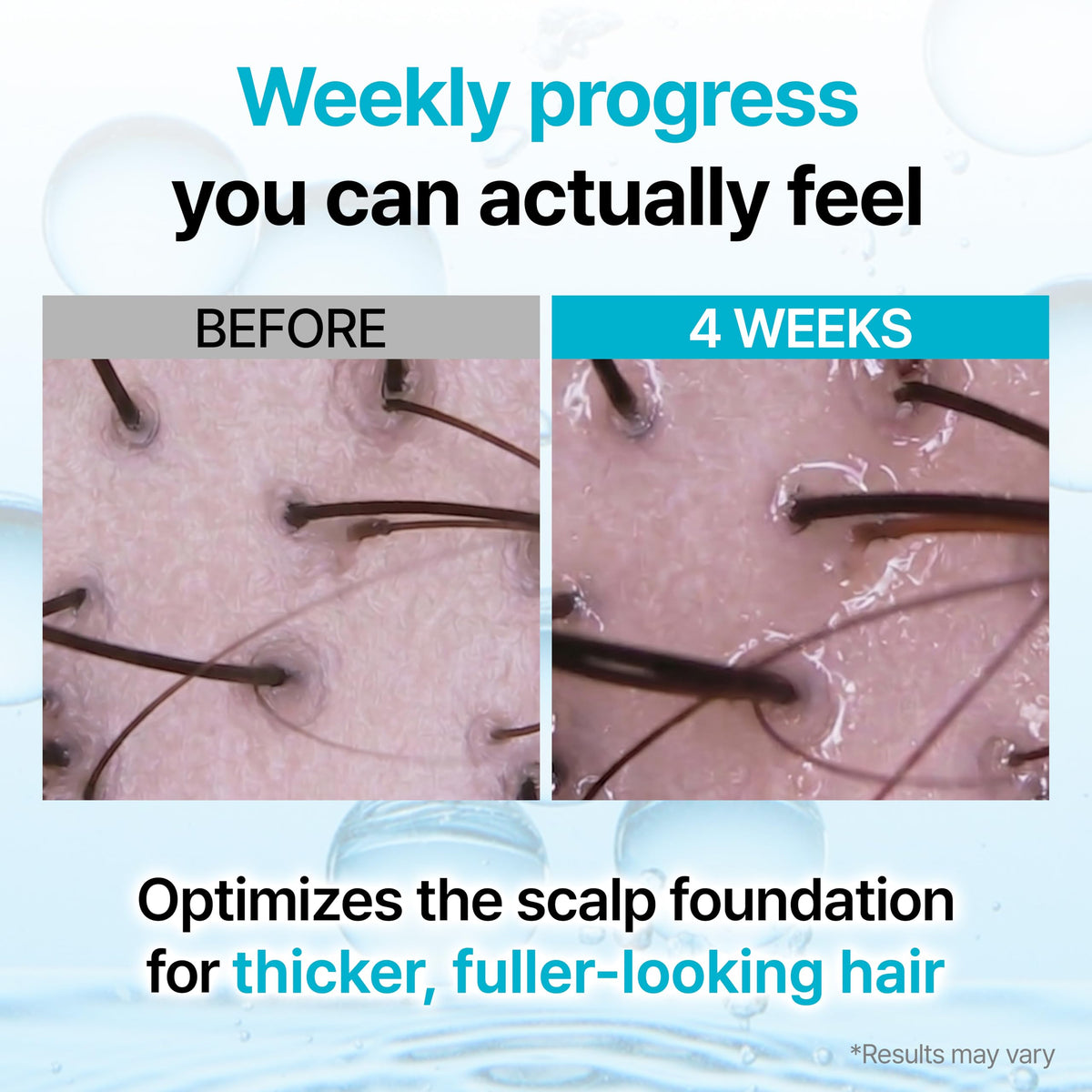 GROWUS applying serum along hairline to target thinning areas