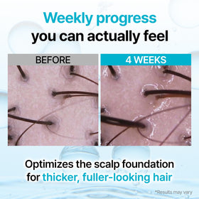 GROWUS applying serum along hairline to target thinning areas