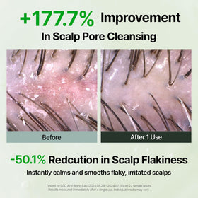 GROWUS shampoo poured into palm producing gentle foam that clarifies scalp