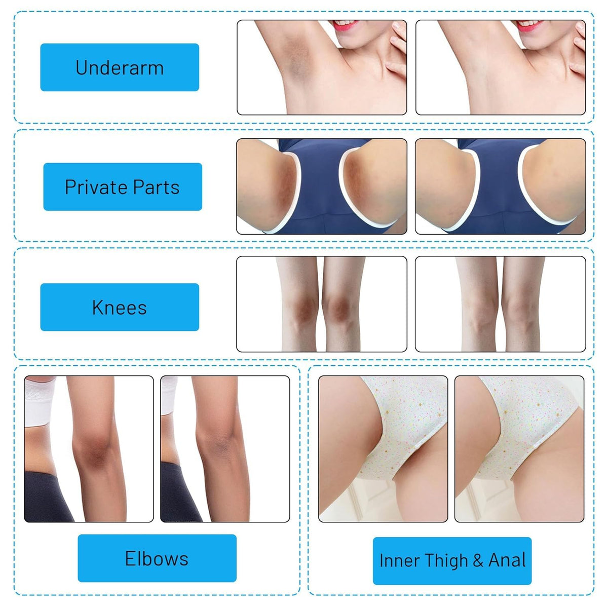 Gukei applied to bikini line showing precise control and comfort