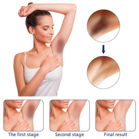 Gukei used on bikini line illustrating targeted dark spot care