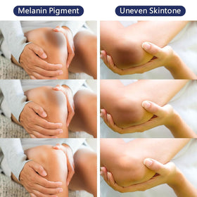 Gukei on knees and elbows displaying scale and coverage benefits
