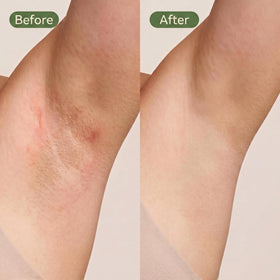 GZCHUANDU applied underarm demonstrating reduced friction benefit