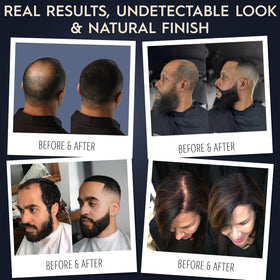hair illusion fibers being applied by hand for targeted coverage