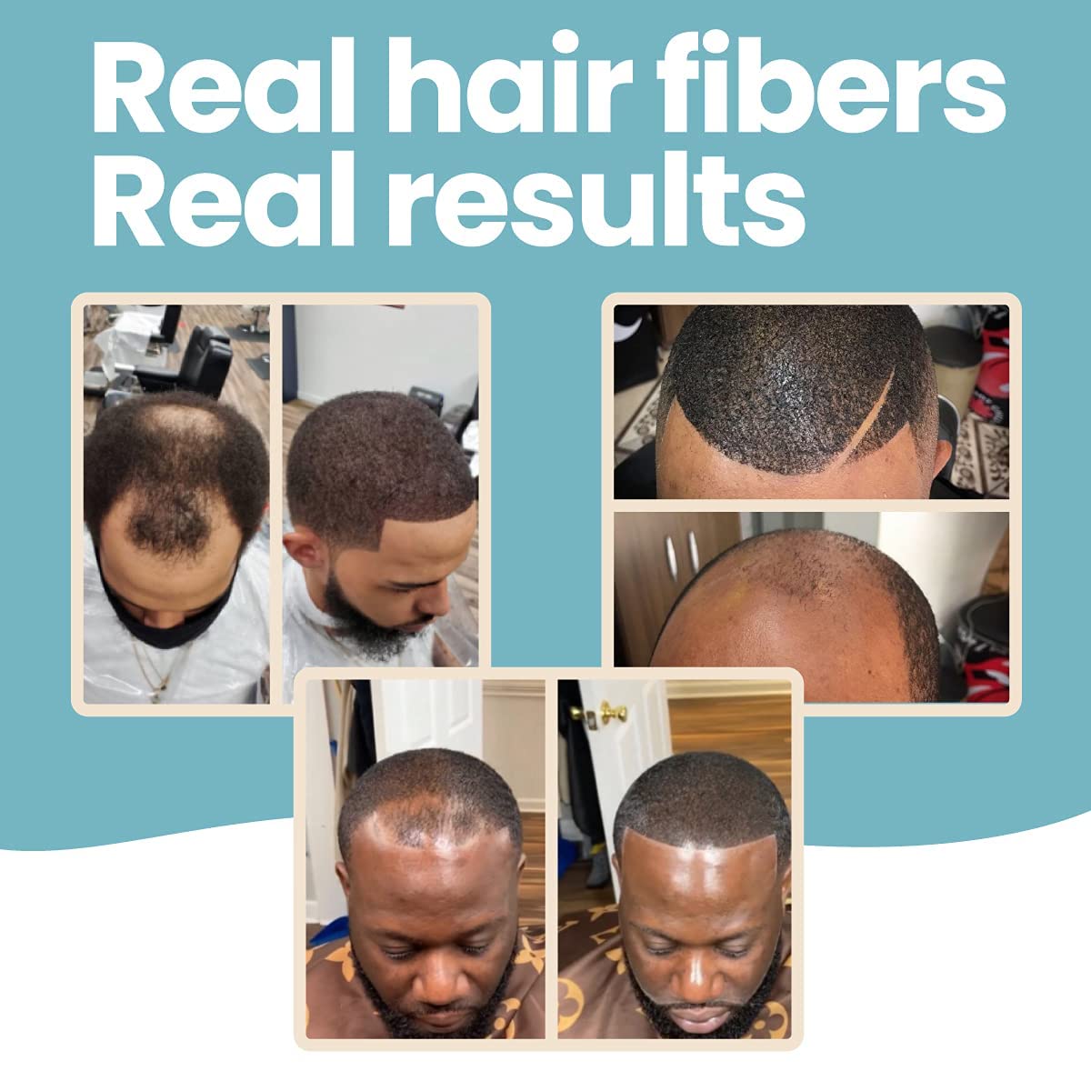 Hair Illusion beard coverage detail masking patchy facial hair naturally
