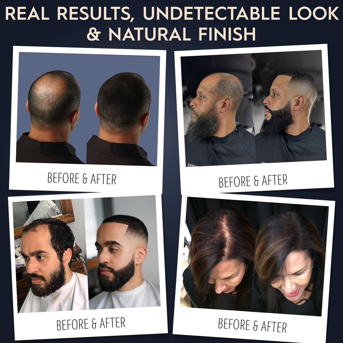 Hair Illusion precision applicator detail for exact placement