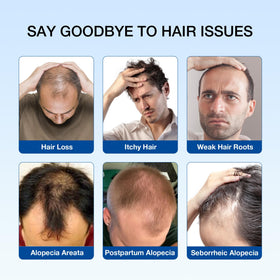 Hair Labs natural ingredient display with rosemary and saw palmetto for scalp health