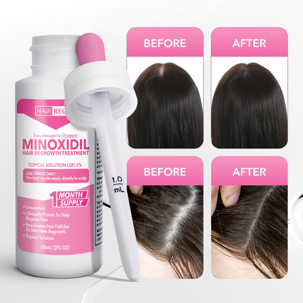Hair Regen bottle label detail displaying concentration and usage guidance clearly