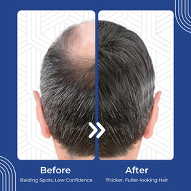 Hair Regen label ingredients close-up showing formula information