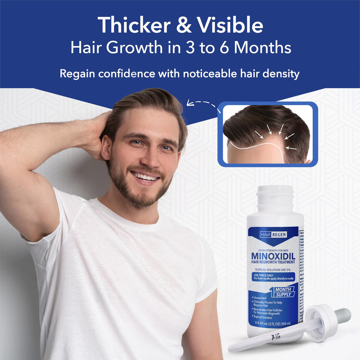 Hair Regen travel kit in bag ready for on-the-go grooming and consistent routine