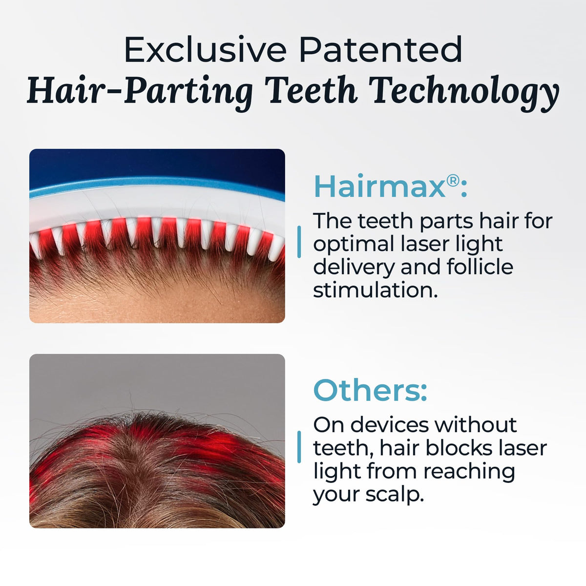 HairMax LaserBand 41 in travel case emphasizing portability and protection