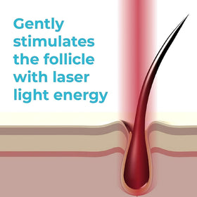 HairMax Ultima 12 being used on scalp demonstrating targeted coverage and non-invasive care