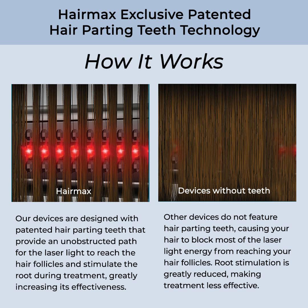 Hairmax Ultima 12 held in hand to show size and portable benefit