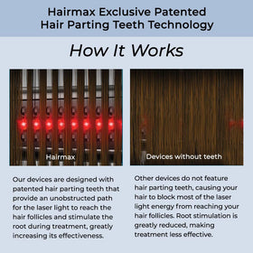 Hairmax Ultima 12 held in hand to show size and portable benefit