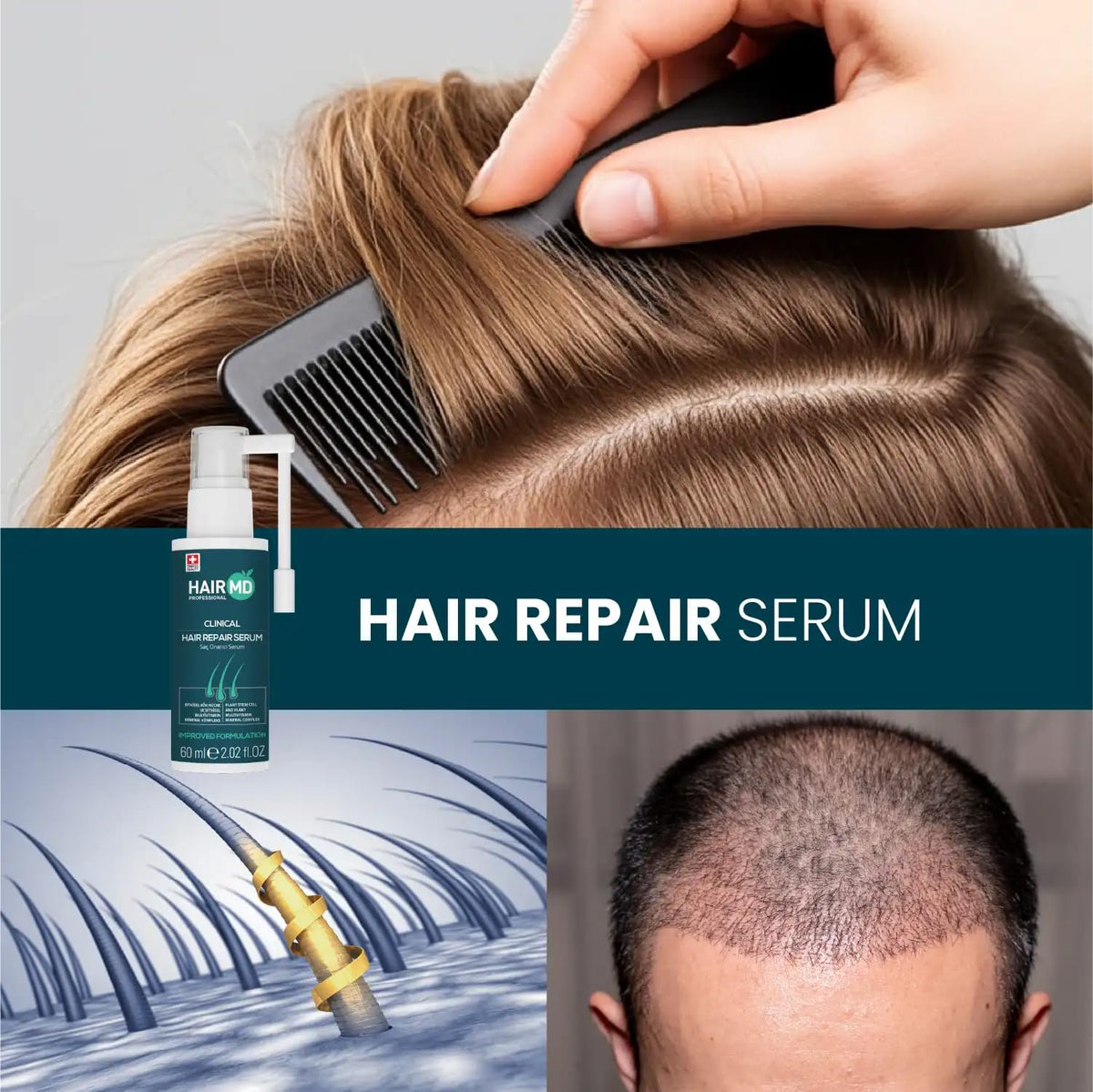 HairMD in a calm recovery setting showing easy at-home post-op care