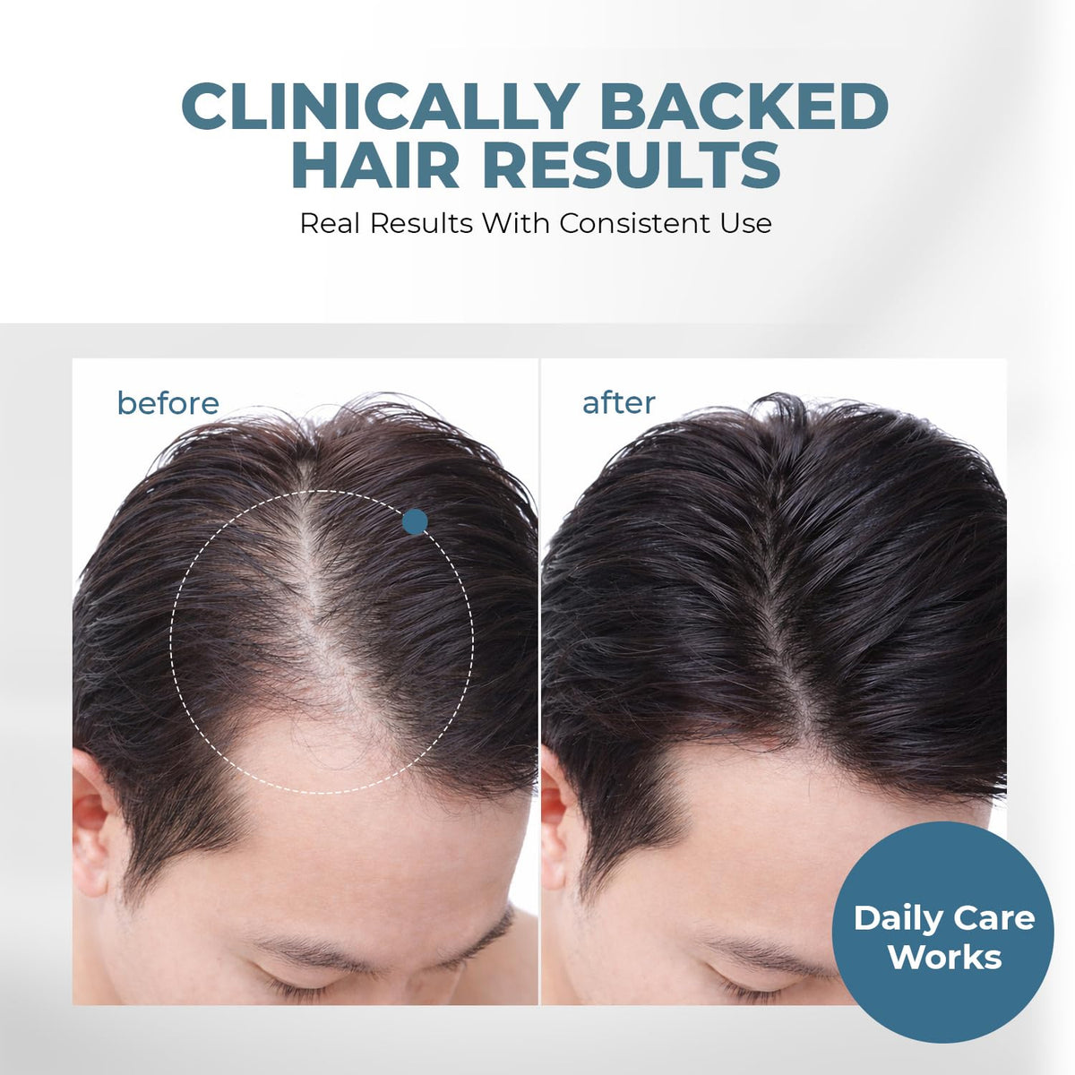 HAIRMETTO dispensing serum from pump highlights easy application