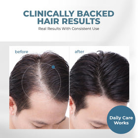 HAIRMETTO dispensing serum from pump highlights easy application