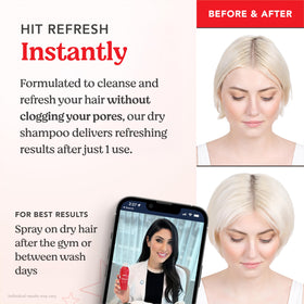 HAIRtamin before and after comparison showing fuller-looking hair