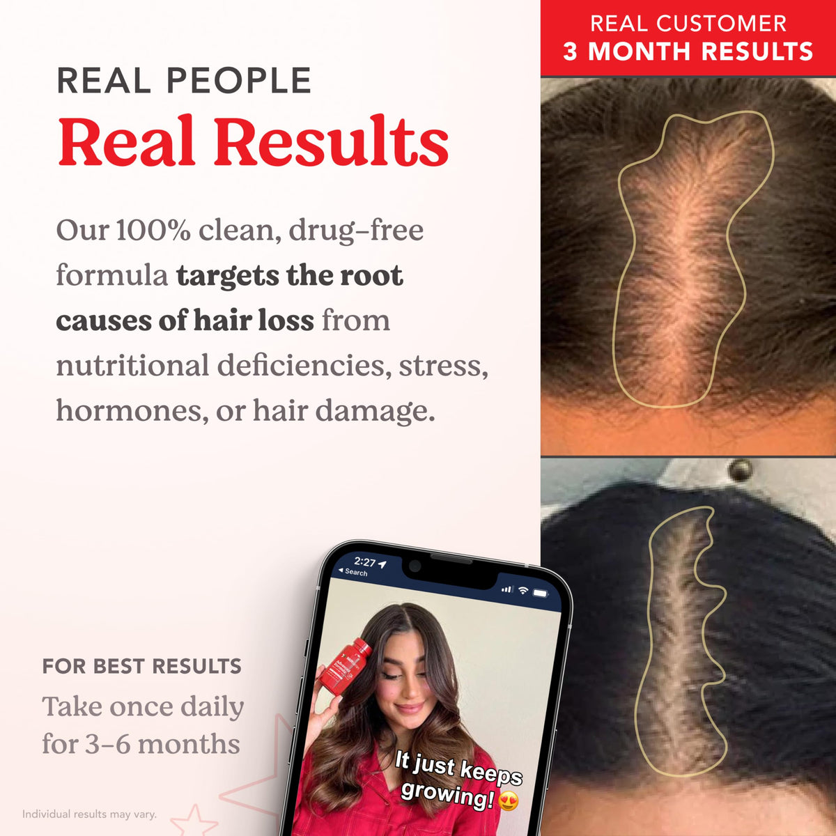 HAIRtamin capsule in hand showing size and easy one-a-day routine