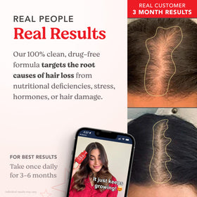 HAIRtamin capsule in hand showing size and easy one-a-day routine