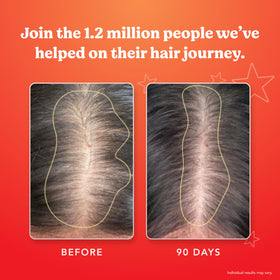 HAIRtamin before and after hair display illustrating thicker-looking results