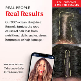 HAIRtamin supplement label close-up highlighting biotin and ingredient transparency