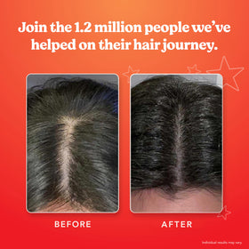 HAIRtamin applying serum to scalp showing targeted use and quick absorption benefit