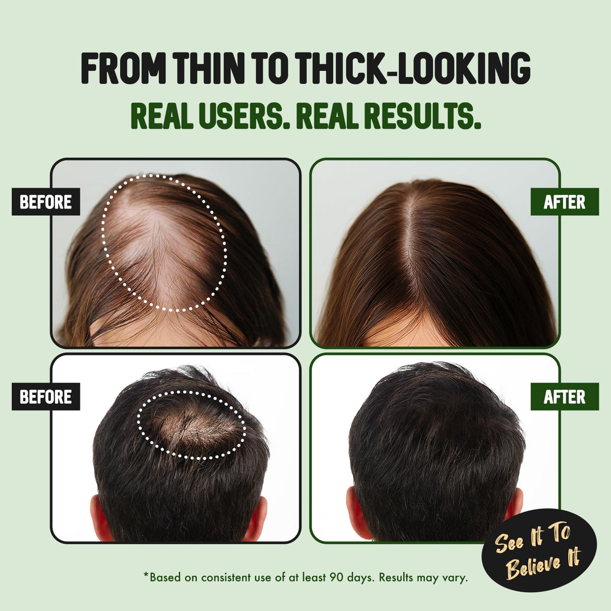 HALOGROW applied at hairline before and after, shows improved appearance