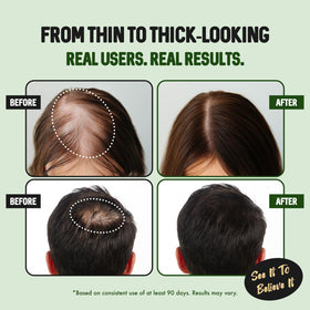 HALOGROW applied at hairline before and after, shows improved appearance