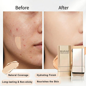 Hanae Korea contour side view showing precise sculpting benefit