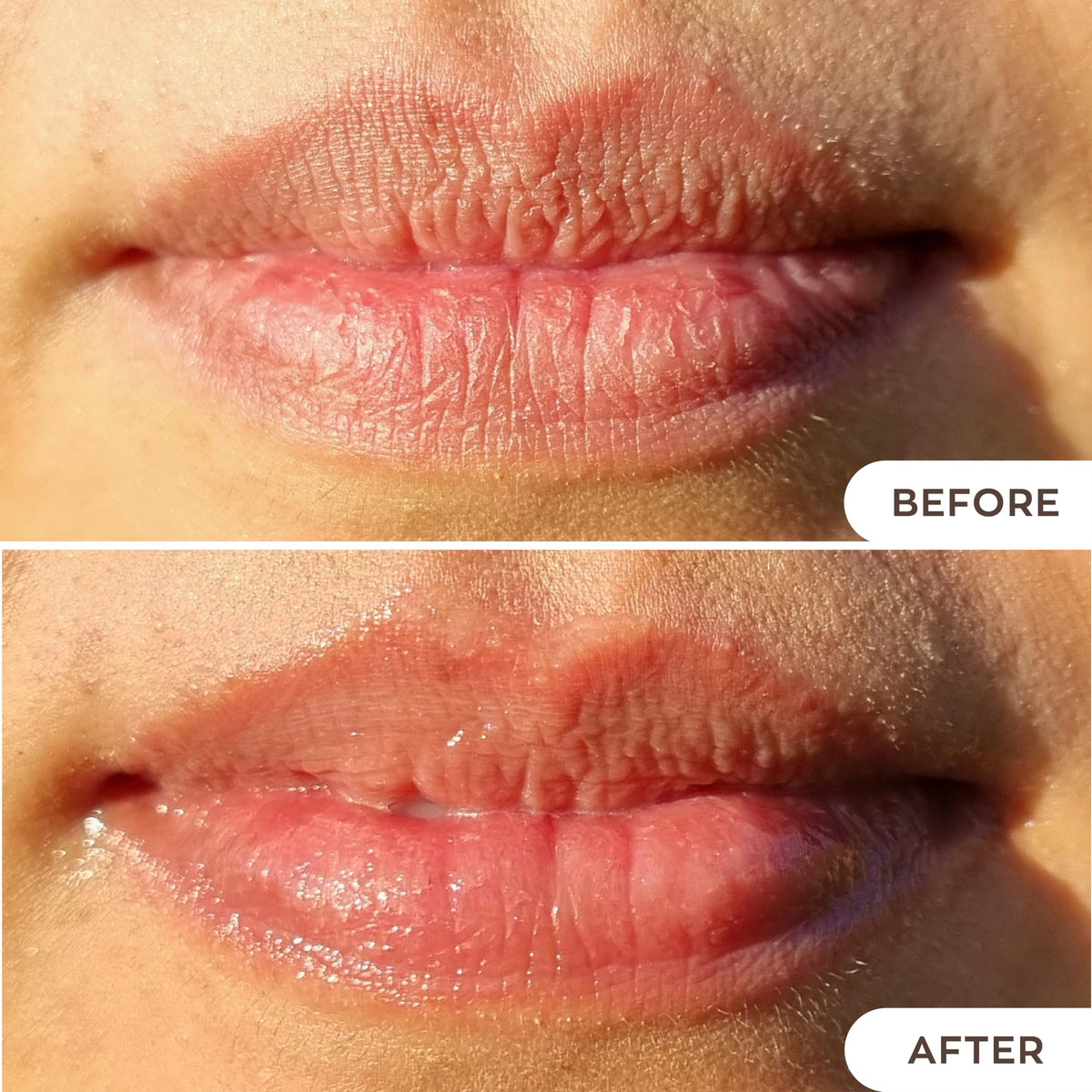Hanalei lips before and after image showing restored softness and visible hydration benefit