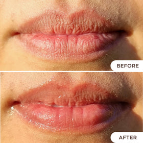 Hanalei lips before and after image showing restored softness and visible hydration benefit