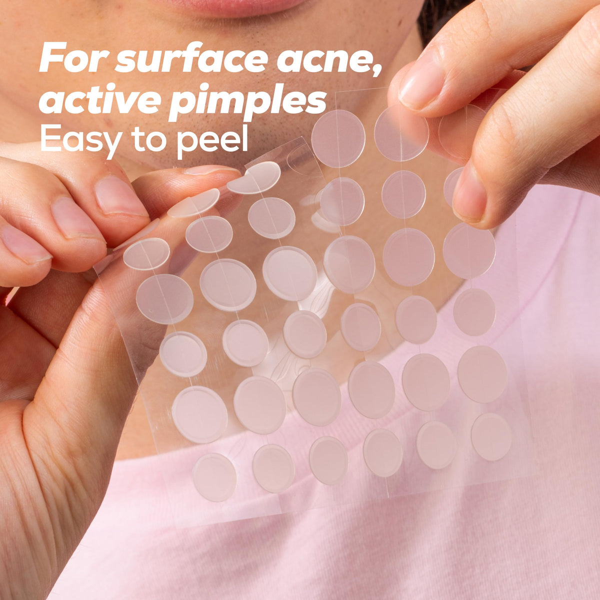 HANHOO patch worn on cheek appearing discreet and providing confident coverage