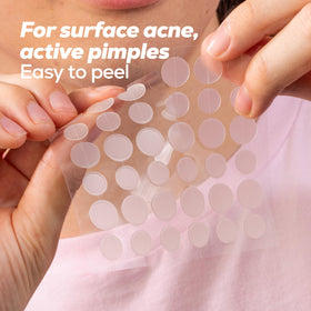 HANHOO patch worn on cheek appearing discreet and providing confident coverage
