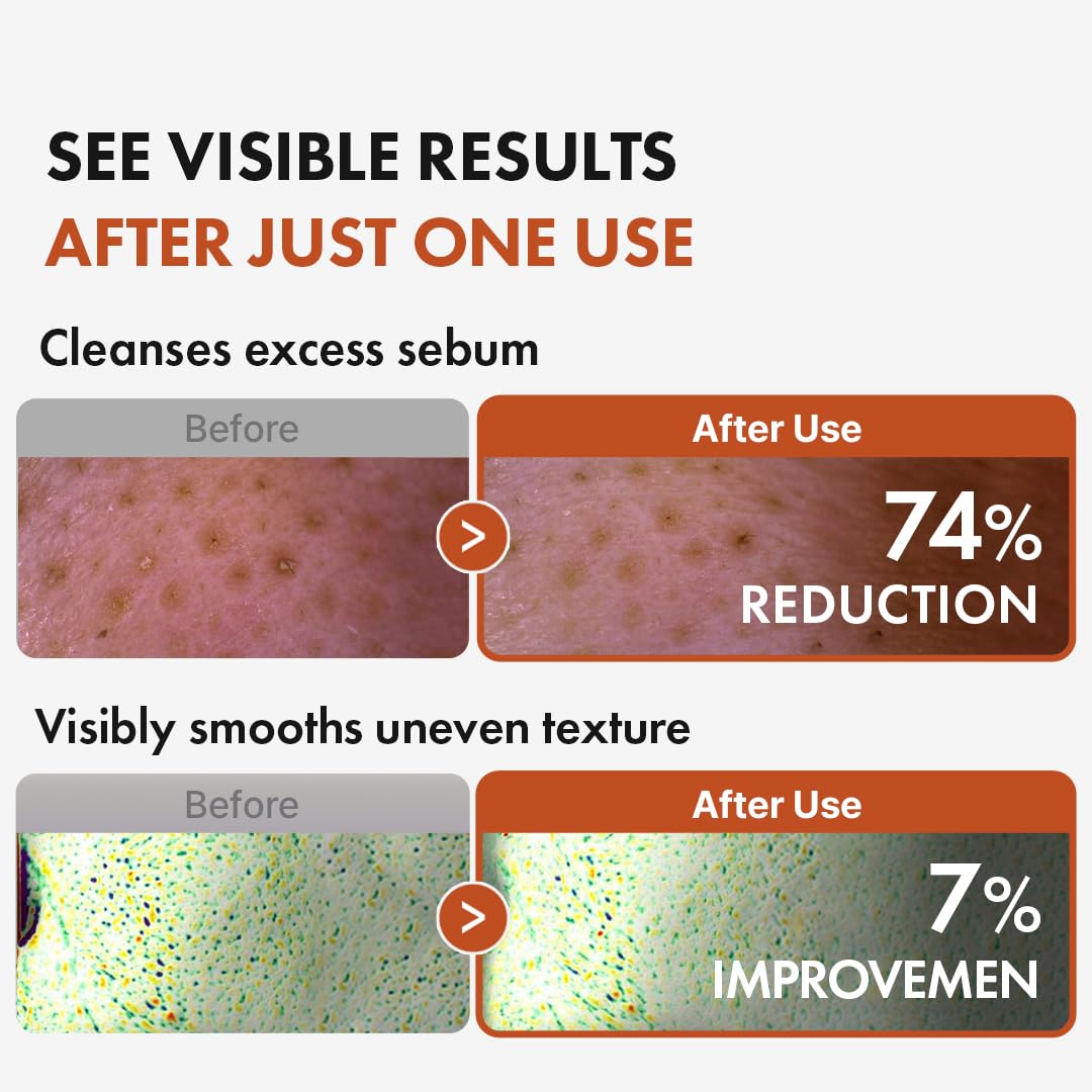 Hanskin texture drop on hand demonstrating lightweight oil absorption benefit