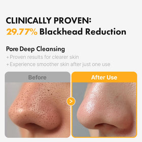 Hanskin ingredient spotlight tea tree oil showing clarifying support benefit