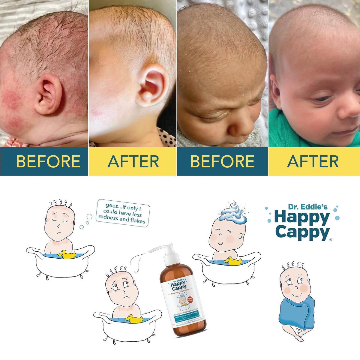 Happy Cappy used during baby bath time in nurturing family setting for relief