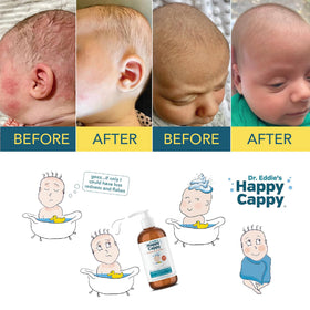 Happy Cappy used during baby bath time in nurturing family setting for relief