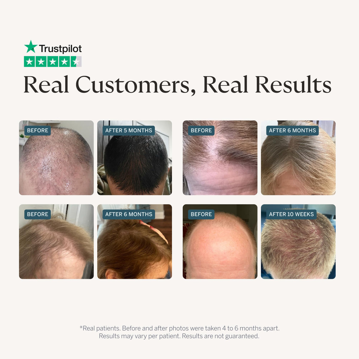 Happy Head dropper dispensing serum onto fingers, precise daily application benefit