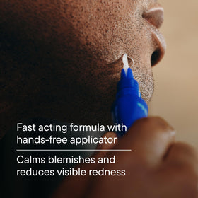 Harry's spot gel applied on a cheek to target a blemish with precise coverage benefit
