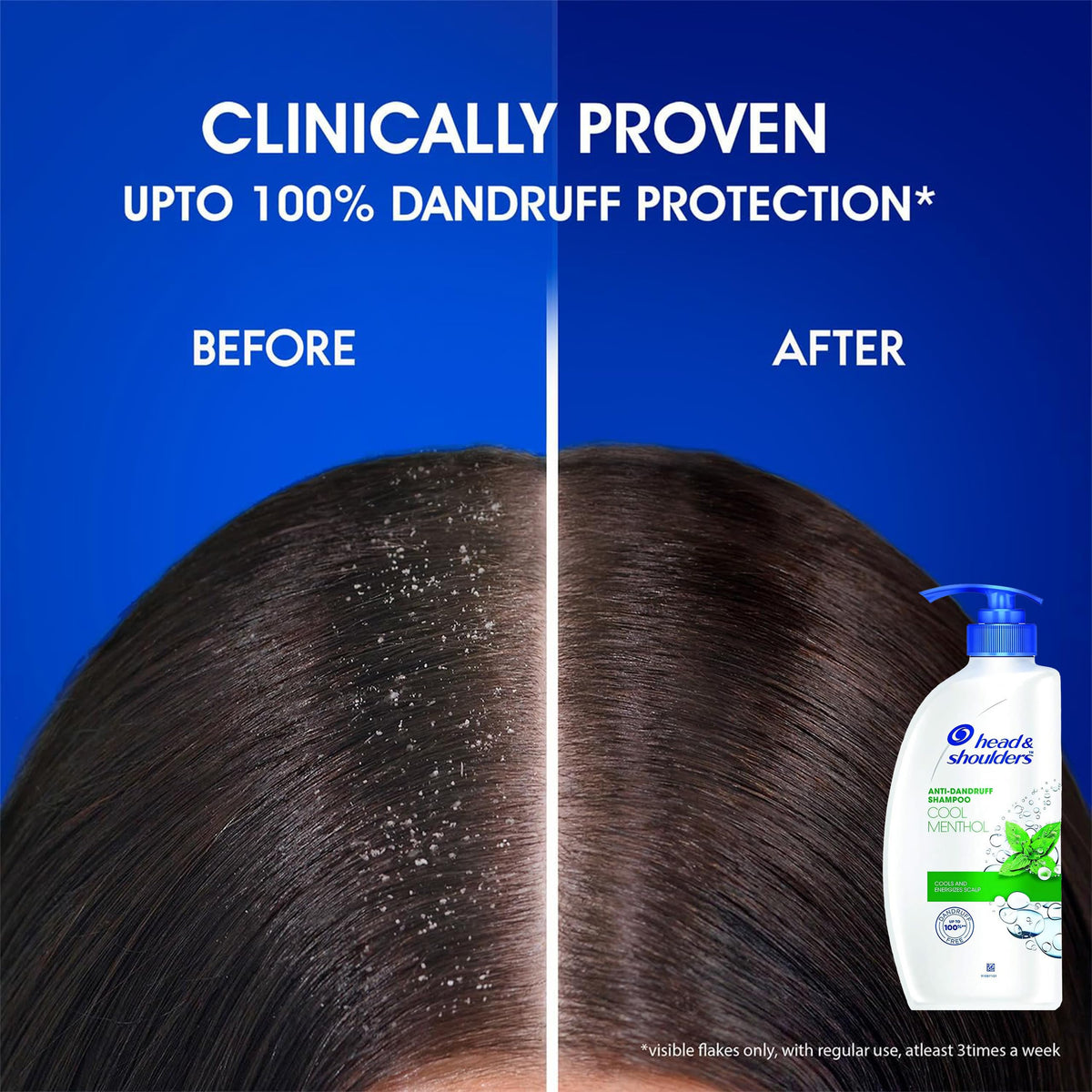After wash hair with Head & Shoulders showing flake-reduced, refreshed look